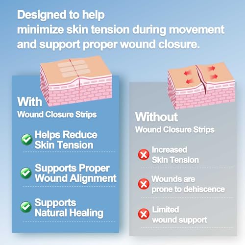 Sterile Reinforced Wound Closure Strips | 12x100mm | 20 Packs | 120 Strips