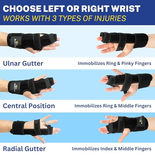 Brace Direct Pro Boxer Fracture Splint - Metacarpal Hand Brace - L3809 Left