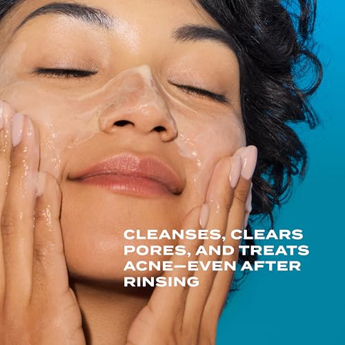 Murad Acne Control Clarifying Cleanser - Salicylic Acid 5 Fl Oz (Pack of 1)