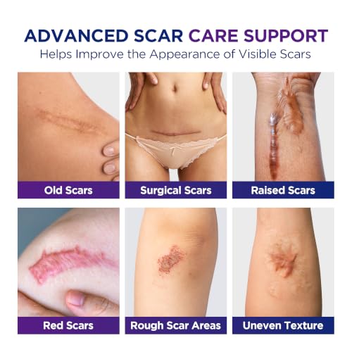 Advanced Silicone Scar Stick - Scar Care for Surgical Scars, C-Section, Burns, Stretch Marks & Acne Marks with Silicone, Vitamin E & Botanical Oils 10g x 2 Sticks