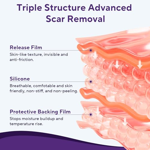 Silicone Scar Sheets, Silicone Scar Tape (1.6"x 60" Roll-1.5m) 1.5M
