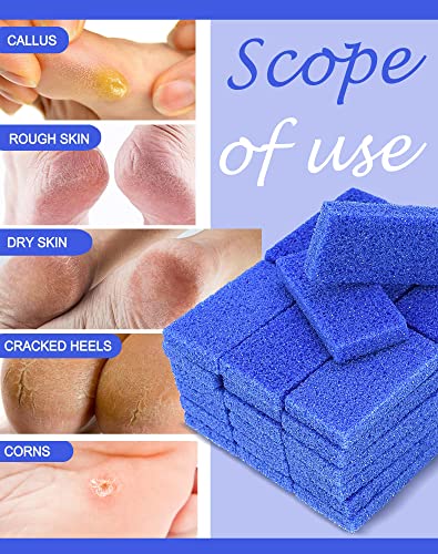 Maryton Disposable Pedicure Pumice Stone for Feet Scrubber, 40PCS Blue 40 Count (Pack of 1)