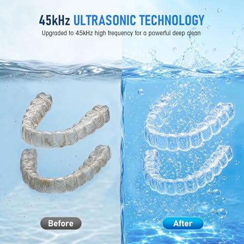 Ultrasonic Retainer Cleaner Machine,45kHz Dental Cleaning Pod with Timer,4 Modes,200ML UV Denture Cleaner,for Retainers,Nightguards,Braces etc.,Snow White Snow White