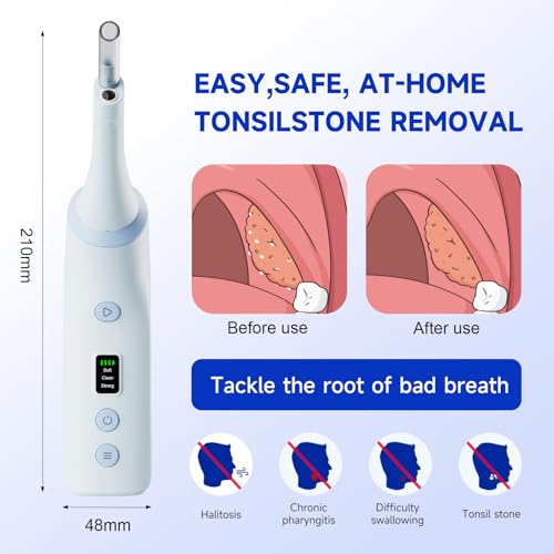 Electronic Tonsil Stone Remover with Camera, Tonsil Stone Removal Kit, 3 Suction Levels, Tonsil Stone Vacuum, Oral Care for Mouth Health, USB Rechargeable(Blue)