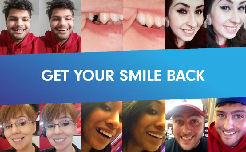 Temptooth #1 Seller Trusted Patented Temporary Tooth Replacement Product