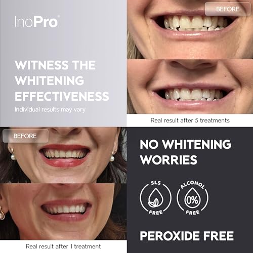 Advanced Teeth Whitening 14 Treatments Kit + Natural Whitening Hydroxyapatite Toothpaste with Probiotic for Sensitive Teeth 5oz