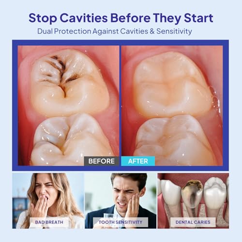 Cavity Healing Tooth Armor Liquid: Clinically Strengthen Enamel with Remineralization Drops at-Home Tooth Enamel Repair Stronger Teeth Hydroxyapatite (180ml, Mint) 0.67 Fl Oz (Pack of 3)