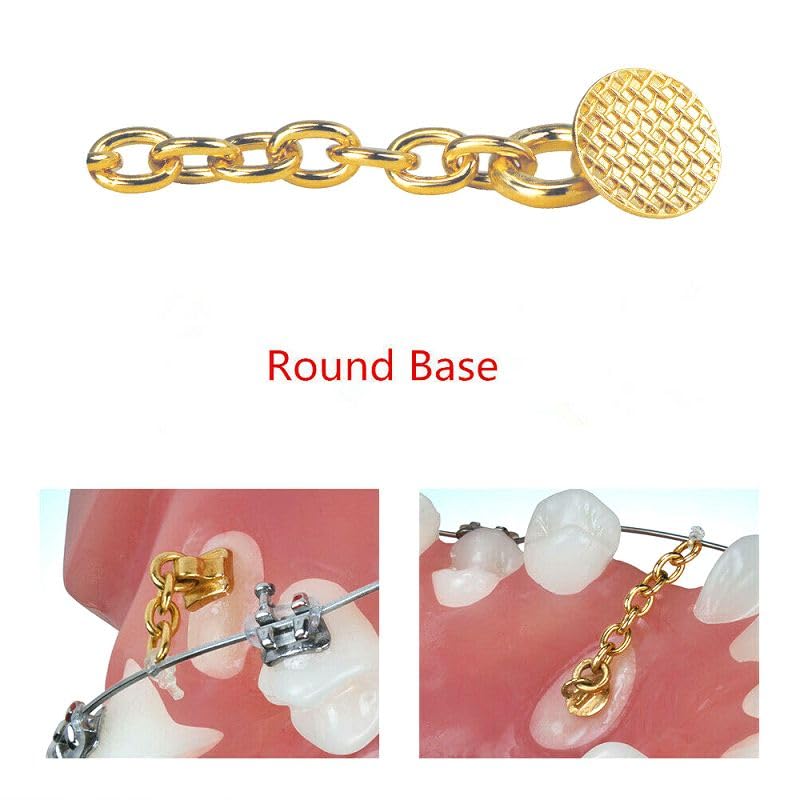 10 Packs Sino Dental Group Orthodontic Braces Eruption Appliance With Traction Chain,Gold/Sliver, Round/Retangular Base (Round, Golden)