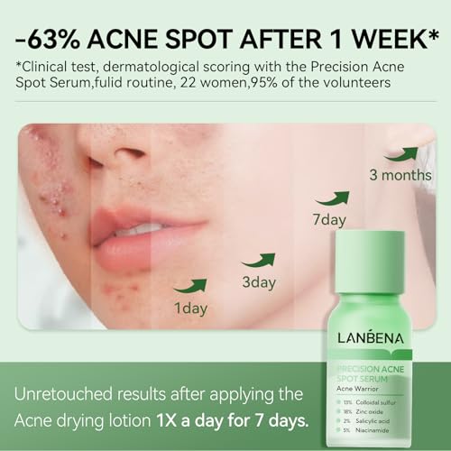 LANBENA 2% Salicylic Acid Acne Spot Treatment Drying Lotion, 0.42 Fl Oz 0.42Fl Oz-18% ZINC OXIDE Acne Dryig Lotion