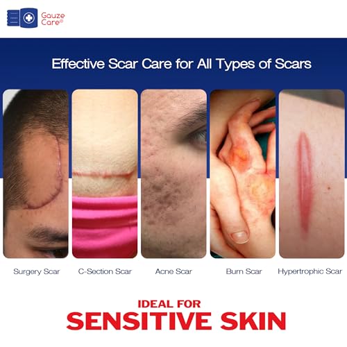GauzeCare Silicone Scar Tape – 1.6”x60” Roll – Medical-Grade, Reusable, Professional Silicone Scar Tape for Surgical Scars, C-Section, Burns, Keloid, and Acne Scars 1.6"x60" - 1 Roll
