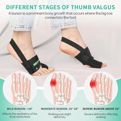 Healrecux Bunion Corrector for Women Men Big Toe, 1 Pair Green