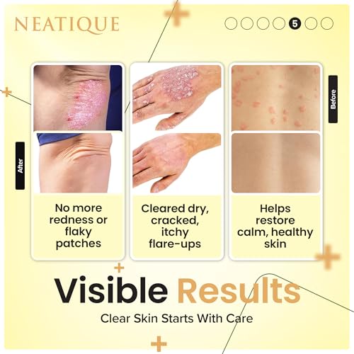 10% Zinc Undecylenate Balm, Foot Care Cream, 2.12 oz