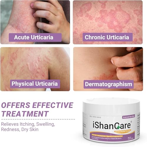 ishancare Urticaria Cream, Fast Acting Relief of Hives, Allergic Rashes, Itchy Skin, Redness, Swelling, Anti Fungal Hives Cream with All Natural Herbal Ingredients, 3.53 Oz 3.53 Oz（100g）
