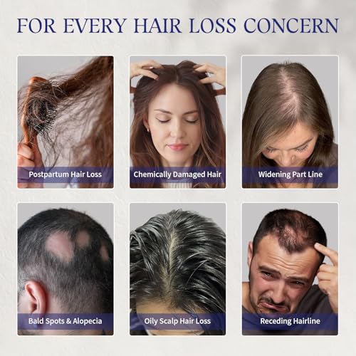 GHK-Cu Copper Peptide Hair Growth Serum for Thinning Hair, Men & Women
