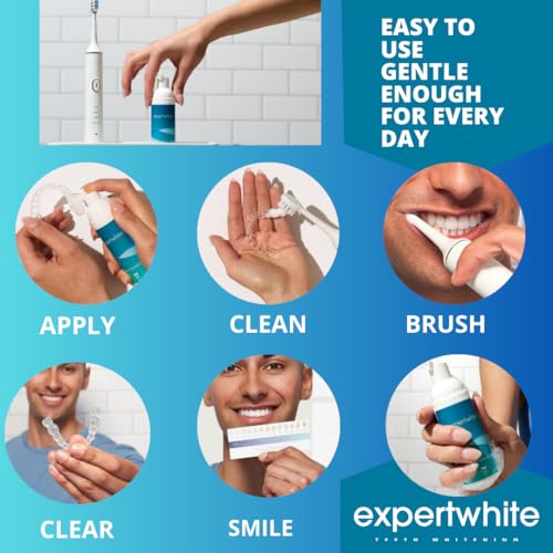 Peroxide Aligner & Retainer Cleaner Foam – Teeth Whitening & Cleaning Foam for Invisalign, Clear Aligners & Night Guards – Non-Abrasive, Enamel-Safe – [1.69fl oz, 150 Treatments]
