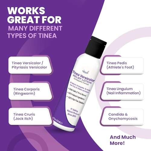 Naturasil Tinea Versicolor Treatment Lotion for Uneven Skin Tone - 4 oz Tinea Lotion