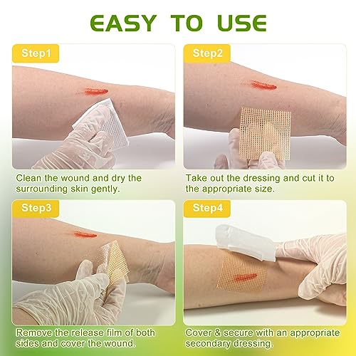 Manuka Honey Gauze Dressing 2"x2" Pack of 10, Manuka Honey Wound Care Bandage for Cuts, Scalds and Burns, Wound Dressing Products