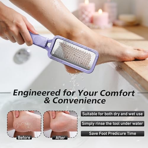 BALUCA Professional Foot File & Callus Remover - Stainless Steel Foot Rasp & Metal Feet Scrubber, Pedicure Tool for Hard Skin & Dead Skin Removal, Cracked Heel Repair for Baby Soft Feet (Purple) Purple