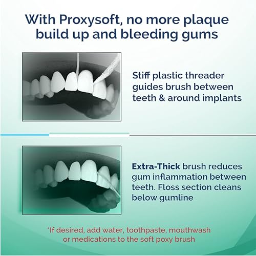 ProxySoft Periodontal Floss - 5pk (250 Strands)