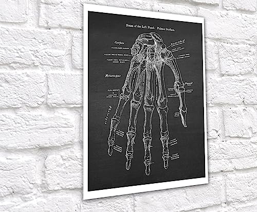 Gnosis Picture Archive Anatomy of Hand Bones Medical Educational Set of 3 Unframed Art Prints Orthopedic Office Decor
