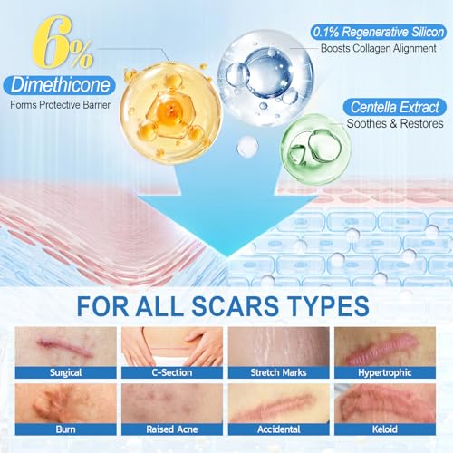 Scar Cream with 6% Dimethicone Formula & Scar Tape Set 1.69 Fl Oz (Pack of 1)