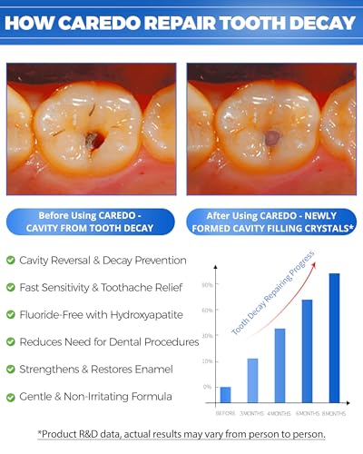 CAREDO Cavity Repair & Oral Comfort Bundle - Hydroxyapatite Toothpaste + Soothing Cream for Gum Swelling, Canker Sores & Sensitive Teeth, Fluoride Free, 3.52 oz + 0.56 oz