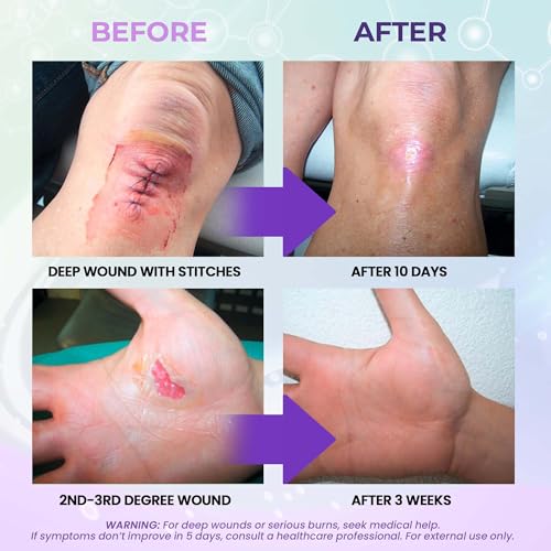 MediQuick Hypochlorous Acid Spray | Wound Care for Cuts, Burns & Rashes
