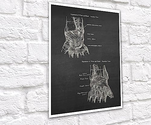 Gnosis Picture Archive Anatomy of Hand Bones Medical Educational Set of 3 Unframed Art Prints Orthopedic Office Decor