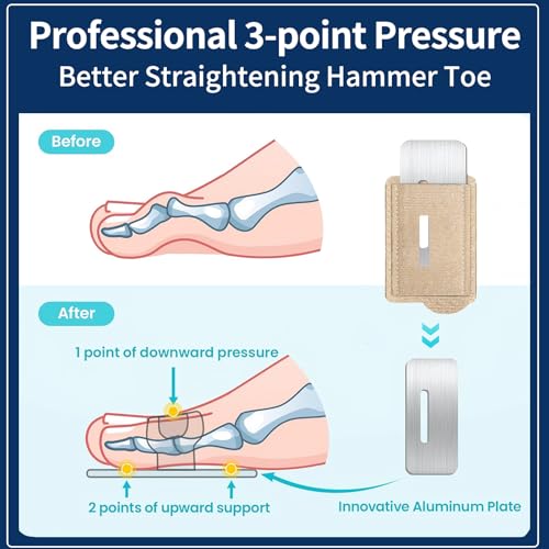 Hammer Toe Straightener, Adjustable Toe Splint with Removable Aluminum Support