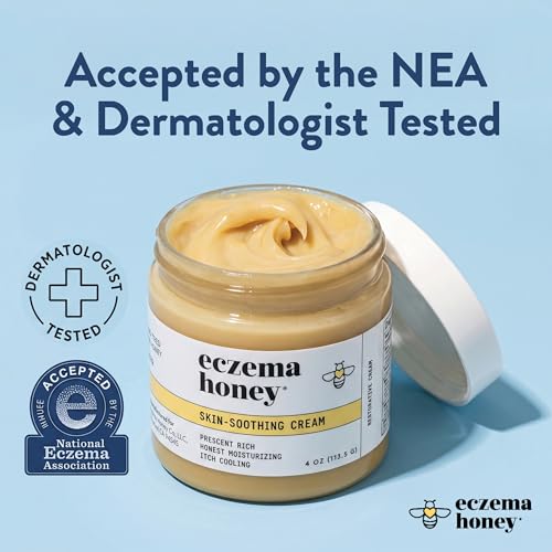 ECZEMA HONEY Original Skin-Soothing Cream for Dry Itchy Skin (4 Oz)