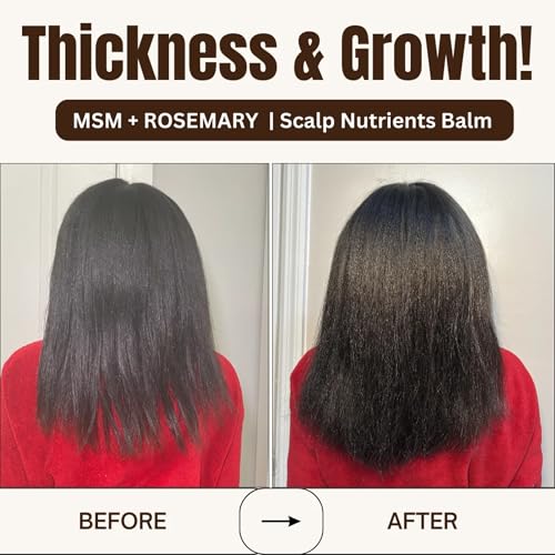 Qhemet Biologics MSM + Rosemary Scalp Nutrients Balm | Food for Hair Growth | MSM, Rosemary, Bhringraj, Castor Oil & Coconut Oil | For Dry Scalp, Thinning & Slow Growth | Vegan (4 oz)