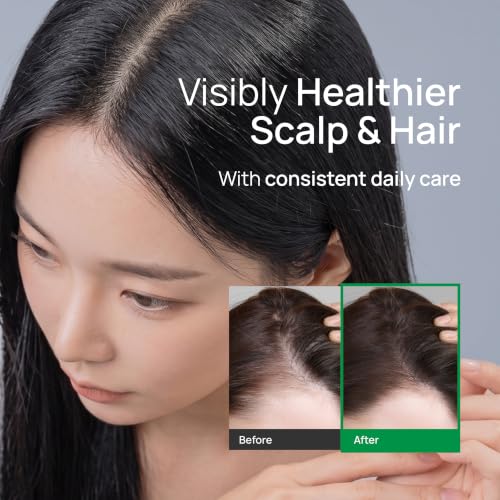 Scalp Serum Strengthening Hair Ampoule - Korean Cooling Hair Growth Serum