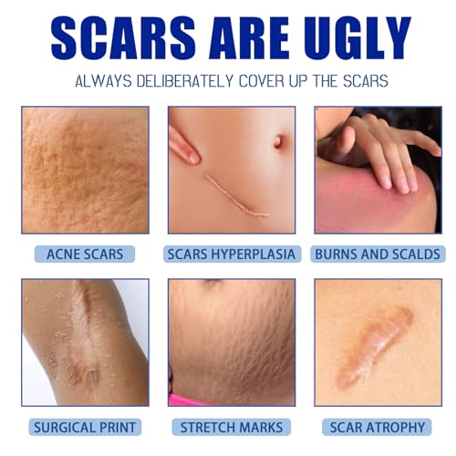 Silicone Scar Gel,Scar Cream,Scar Silicone Gel,Scar Removal Cream,Scar Gel,Scar Cream for Surgical Scars and Keloid Bump (1pcs)