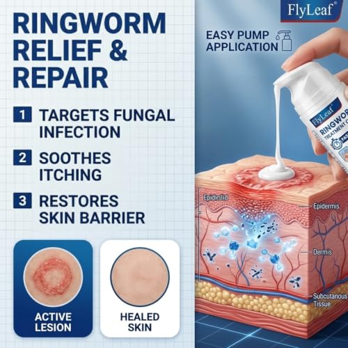 Antifungal Ringworm Treatment Cream, - Miconazole Nitrate 2% Antifungal Cream for Humans - For Fast Itch Relief, Jock Itch & Athlete's Foot - Cream with Ceramides & Tea Tree Oil, Non-Greasy, 3.53oz