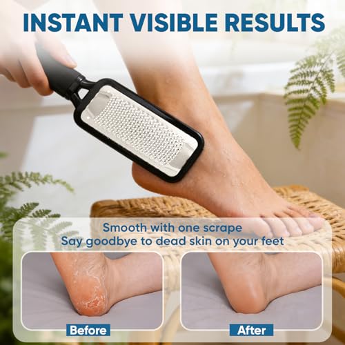 TEAWOO 3 Pack Foot Files Callus Remover, Stainless Steel Foot Rasp and Foot Scrubber, Professional Pedicure Tools for Dead Skin, Hard Skin and Calluses Removal 3p