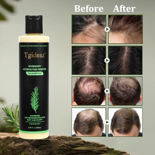 Tgideas Rosemary Biotin Volumizing Shampoo for Thinning Hair, 2Pack Rosemary - Shampoo*2(14.8 Fl Oz)