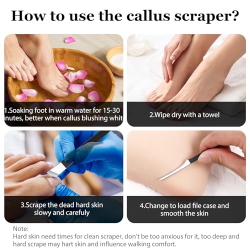 6PCS Ingrown Toenail Removal Kit, Stainless Steel Removal Pedicure Scraper Professional Pedicure Tools Set with Storage Box Callus Shaver Foot Care for Dead Dry Hard Cracked Skin