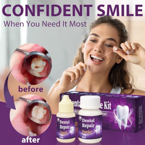 Zinc Oxide Eugenol Dental Cement, Tooth Repair Kit for Crowns, Fillings and Chipped Teeth, Temporary Teeth Fix Dental Care Kit