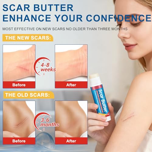 Scar Stick, with Vitamin E, Cocoa Butter & Coconut Oil, 5-in-1 Skin Nourishing Formula, Effectively Reduces Appearance of Scars & Fine Lines, Skin Recovery Support, Pack of 2 0.7 Ounce (Pack of 2)