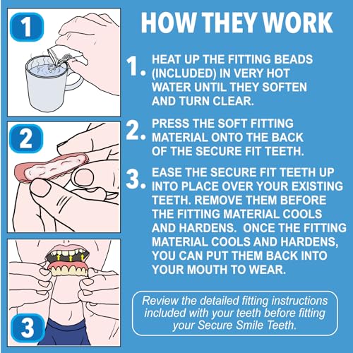 Instant Smile Secure Fit Upper Teeth Veneer -