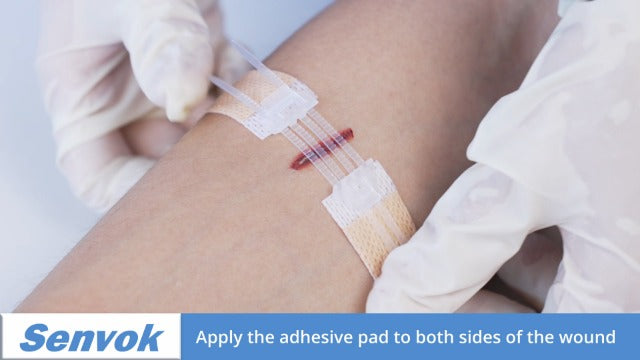 Wound Closure Device 4 Pcs - Zip Sutures & Butterfly Bandage | Stitchless Wound Repair, Rapid Hemostasis for Hiking, Camping, Wilderness Survival | Outdoor First Aid Essentials Non-woven 4 PCS