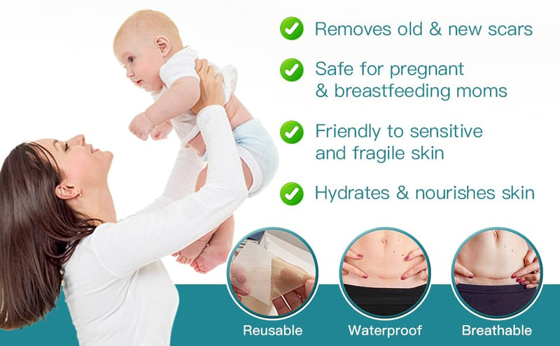 Silicone Scar Thicked Sheets,C Section Recovery Kit 2in x 8in 10ct | Reuseable Extra Long Scar Strips for Reducing the Appearance of Keloid Bump,Stretch Marks,Burn,Surgical Scar Removal(Latex Free)
