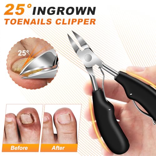 Toenail Clippers for Thick Toenails, Angled Head Toe Nail Clippers with Catcher, 360° Rotating Nail Clippers for Men, 37mm Wide Opening Nail Cutter for Ingrown Toenails, 5PCS Seniors Foot Repair Set Ingrown & Angled & Rotating