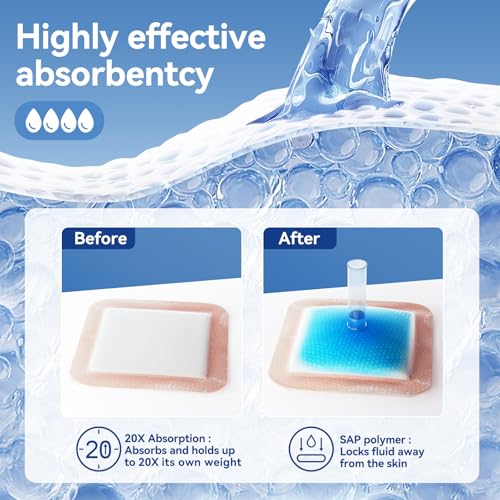 Niceful Silicone Super Absorbent Wound Dressing-4"× 4" Self-Adhesive Bandages for Wound Care, FSA HSA Eligible, Ultra Soft Wound Pads for Bed Sores Leg Ulcers Burns, 10 4"x 4"