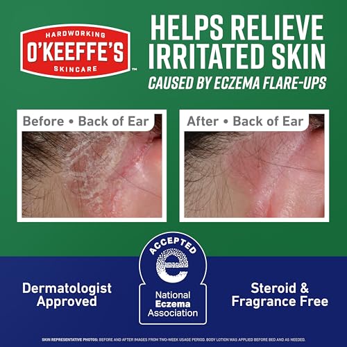 O’Keeffe’s Skin Repair Eczema Relief Body Cream, 7oz Tube (Pack of 1) 7 Ounce (Pack of 1)