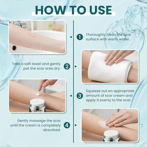 Scar Cream Gel Silicone Removal for Surgical Scars Burn Old Scars Acne Face Stretch Marks Hypertrophic Keloid wait Silicone Gel For Scars Topical Remover 2Pack 1.7 Oz