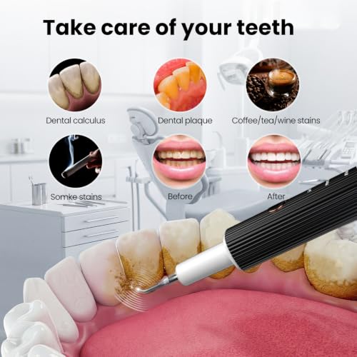 Ultrasonic Tooth Scaler Plaque Remover for Teeth - Tartar Remover for Teeth