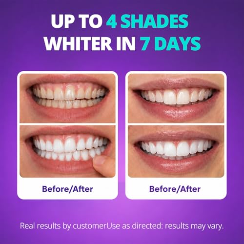 SAKYPRORAL Triple Whitening Strips, Long-Lasting Results, Enamel Safe & Low-Sensitivity, Purple Tooth whitening, Peppermint, 56 Count 56 Count (Pack of 1)