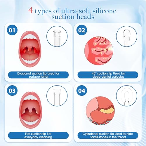 Upgraded Electronic Tonsil Stone Remover with 3-Speed Vacuum & LED Light