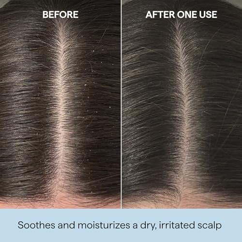 Briogeo Scalp Revival Rosemary Pre-Wash Oil | Moisturizing Scalp Treatment for Dry, Flaky, or Itchy Scalp | Strengthens Hair & Soothes Scalp | Vegan & Cruelty-Free 1 Fl Oz